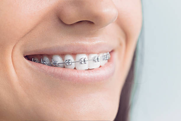 Best Invisalign and Clear Aligners  in Montgomeryville, PA